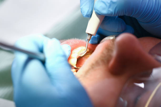 Best Emergency Dentist Near Me  in Little Cypress, TX