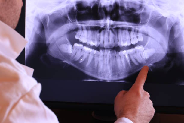 Best Broken Tooth Emergency  in Little Cypress, TX