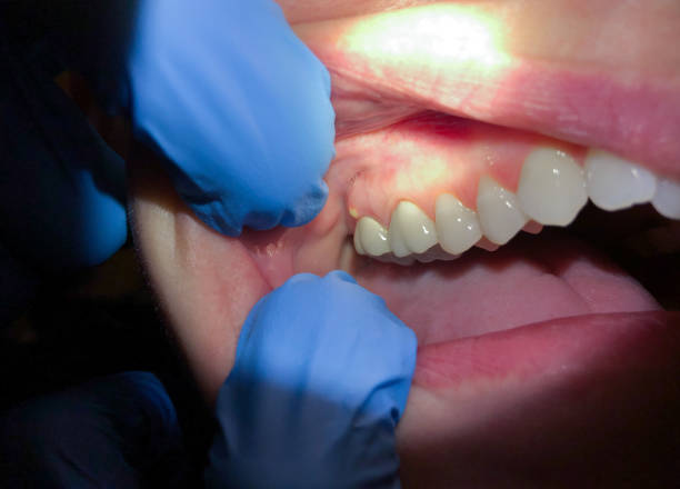 Best Dentist for Dental Trauma  in Little Cypress, TX