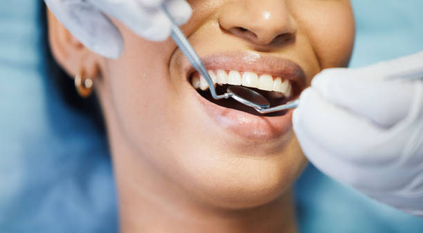 Best Emergency Gum Pain Relief  in Little Cypress, TX