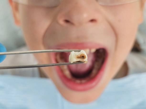 Best Dentist for Severe Toothache  in Little Cypress, TX