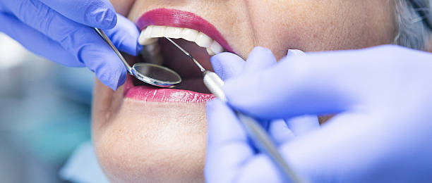 Best Teeth Whitening  in Little Cypress, TX